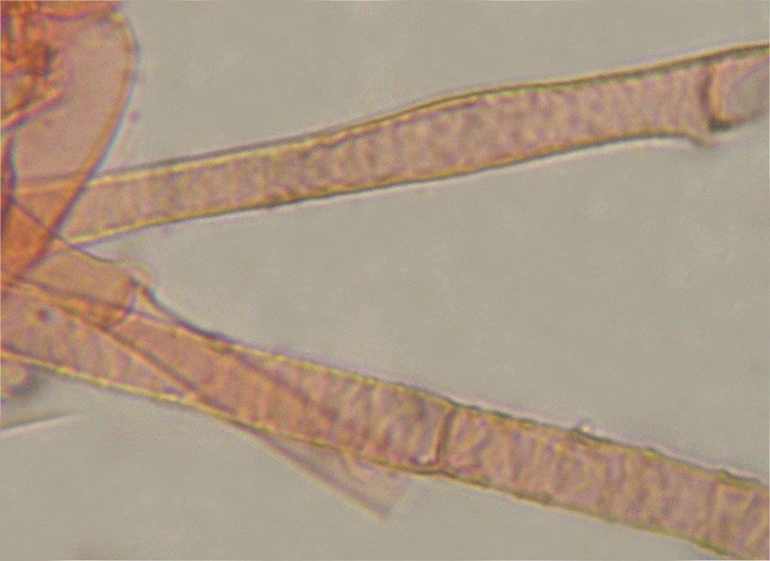 Clitocybe costata 6754 encrusted hyphae.jpg