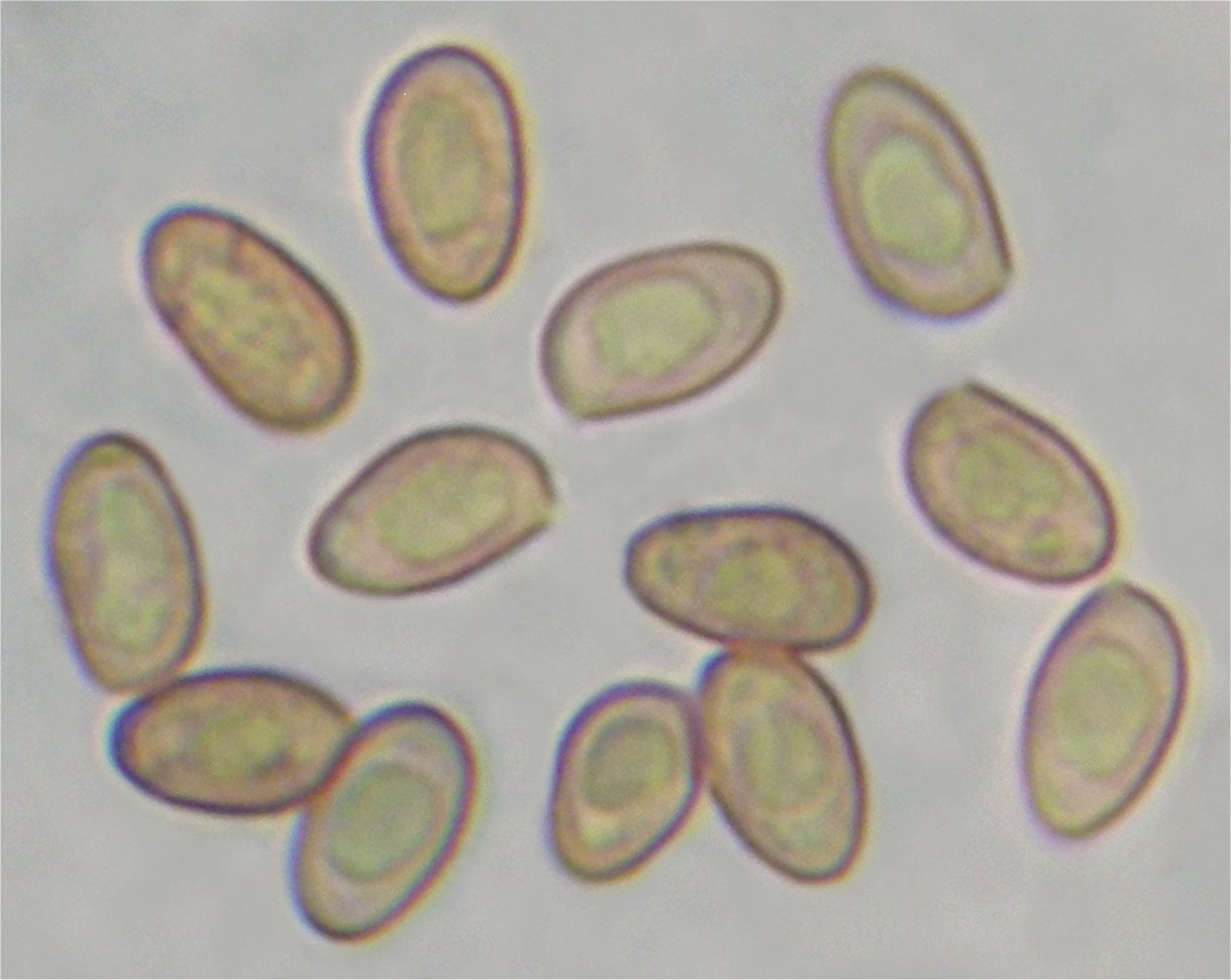 Cortinarius acutus 24608 spores.jpg