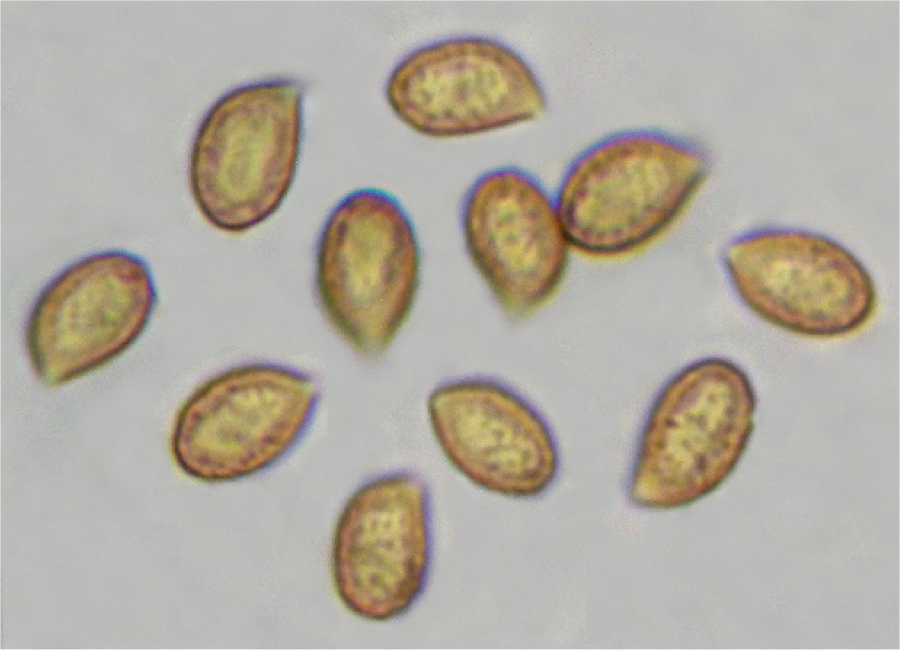 Cortinarius vibratilis 24708 spores.jpg