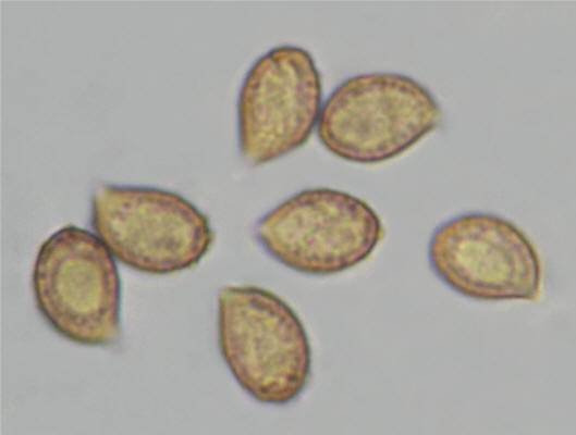 Cortinarius bovinus 19489 spores 8 9 x 57 63_small.jpg