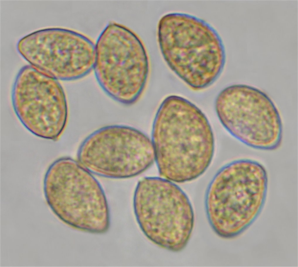 Cortinarius caperatus spores.jpg