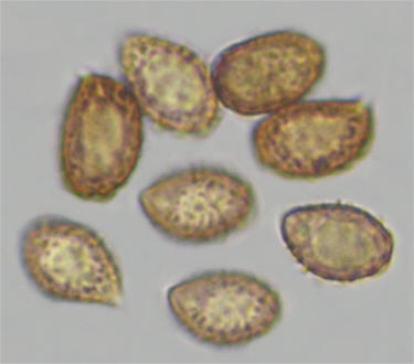 Cortinarius levipileus 19753 spores_small.jpg