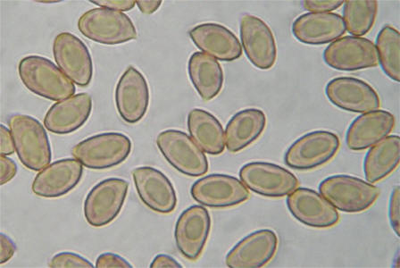 Cortinarius multiformis 4283 spores_small.jpg