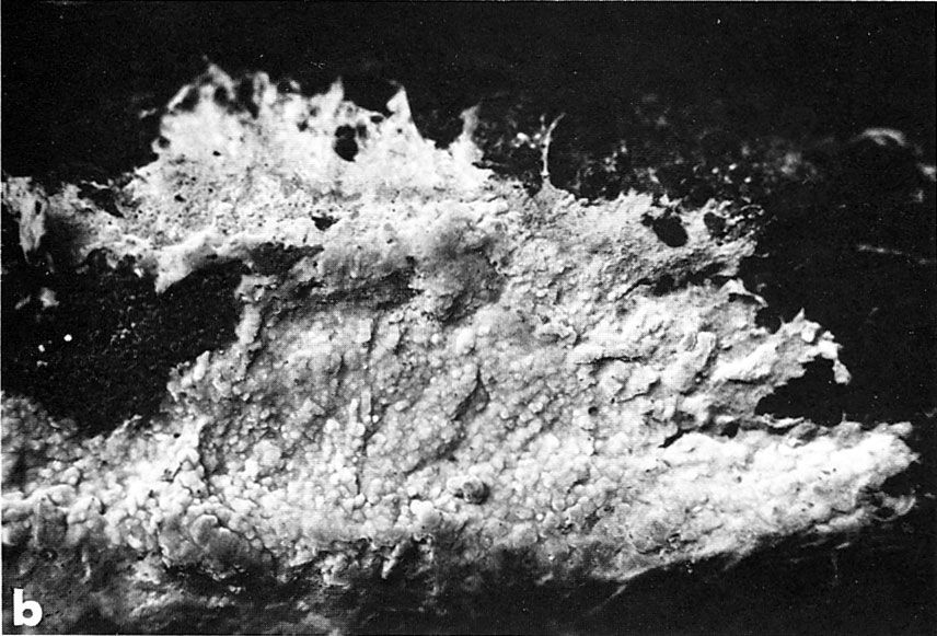 TempF10973_Phanerochaete-filamentosa-fig6.jpg