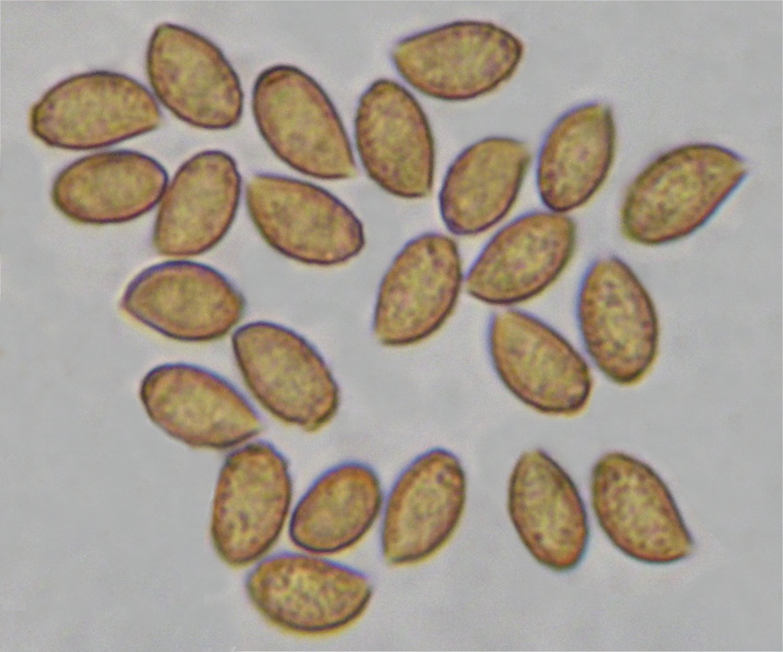 Cortinarius 30860 spores.jpg