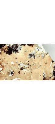 황백고약버섯(황미세고약버섯) (Ramaricium albo-ochraceum (Bres.) Jül.  > Trechispora albo-ochracea)